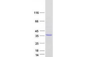 Validation with Western Blot (OGFOD2 Protein (Myc-DYKDDDDK Tag))