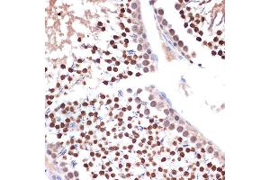 Immunohistochemistry of paraffin-embedded rat testis using NUP153 Rabbit mAb (ABIN1512527, ABIN3023298, ABIN3023299 and ABIN7101477) at dilution of 1:100 (40x lens). (NUP153 抗体)