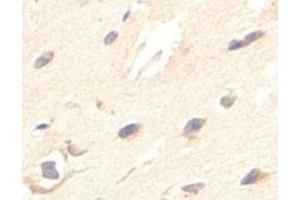 Immunohistochemical analysis of paraffin-embedded human fetal brain showing cytoplasmic staining with ZBED5 polyclonal antibody  at a 1 : 100 dilution.