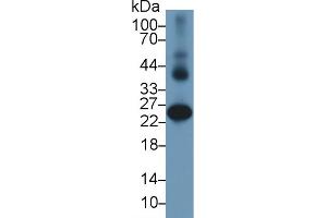 Detection of GSTa2 in Human Liver lysate using Polyclonal Antibody to Glutathione S Transferase Alpha 2 (GSTa2) (GSTa2 抗体  (AA 1-222))