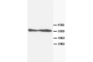 Western Blotting (WB) image for anti-Protein Phosphatase 3, Catalytic Subunit, alpha Isoform (PPP3CA) antibody (ABIN1108716) (PPP3CA 抗体)