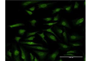 Immunofluorescence (IF) image for anti-ATPase, H+ Transporting, Lysosomal 31kDa, V1 Subunit E1 (ATP6V1E1) (AA 1-226) antibody (ABIN947601)