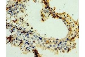 Immunohistochemistry of paraffin-embedded human testis tissue using ABIN7159272 at dilution of 1:100 (MAGEA6 抗体  (AA 75-314))