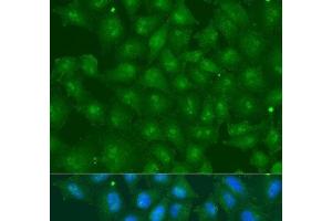 Immunofluorescence analysis of U2OS cells using ZBTB20 Polyclonal Antibody at dilution of 1:100. (ZBTB20 抗体)