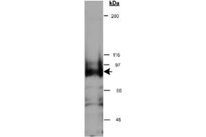 Western blot analysis of CYTSB in HeLa whole cell lysate (RIPA) using CYTSB polyclonal antibody  at 0. (NSP5 抗体  (AA 1-100))