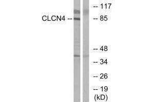 Western blot analysis of extracts from MCF-7 cells, using CLCN4 antibody. (CLCN4 抗体)
