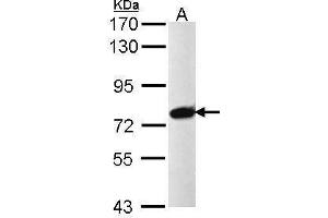 PRPF39 anticorps