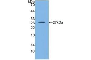 Detection of Recombinant GSTm1, Mouse using Polyclonal Antibody to Glutathione S Transferase Mu 1 (GSTM1) (GSTM1 抗体  (AA 1-218))