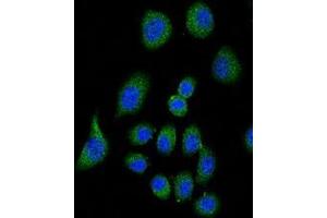 Confocal immunofluorescent analysis of CFH Antibody (Center) with A549 cell followed by Alexa Fluor® 489-conjugated goat anti-rabbit lgG (green).