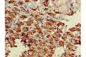 Immunohistochemistry of paraffin-embedded human adrenal gland tissue using ABIN7145531 at dilution of 1:100 (BACE1 抗体  (AA 46-155))