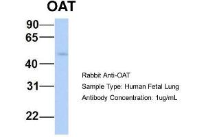 Western Blotting (WB) image for anti-Ornithine Aminotransferase (OAT) (Middle Region) antibody (ABIN2783233)