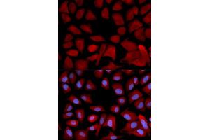 Immunofluorescence analysis of U2OS cells using PSMC4 antibody (ABIN5971339). (PSMC4 抗体)