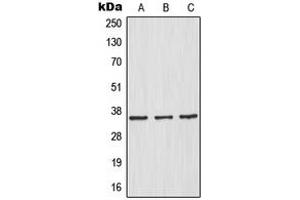 Western blot analysis of IKB alpha expression in HeLa (A), HepG2 (B), Raw264. (NFKBIA 抗体  (N-Term))