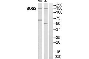 Western blot analysis of extracts from K562 cells and Jurkat cells, using SOS2 antibody. (SOS2 抗体  (Internal Region))