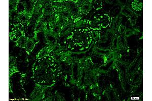 Formalin-fixed and paraffin embedded mouse kidney labeled with Anti-C3 Polyclonal Antibody, Unconjugated (ABIN681913) at 1:200 followed by conjugation to the secondary antibody Goat Anti-Rabbit IgG, FITC conjugated used at 1:200 dilution for 40 minutes at 37°C (C3 抗体  (AA 1551-1663))