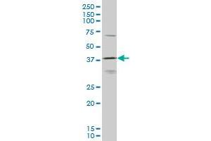 HOXD11 monoclonal antibody (M10), clone 6C8 Western Blot analysis of HOXD11 expression in K-562 .