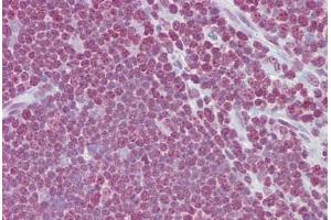 Anti-CD40LG / CD54 antibody IHC staining of human thymus. (CD40 Ligand 抗体  (AA 108-157))