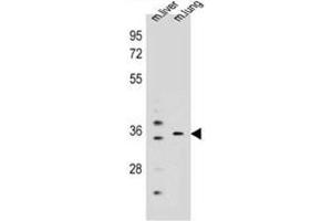 Western blot analysis of KCNRG Antibody (C-term) in mouse liver,lung tissue lysates (35ug/lane). (KCNRG 抗体  (C-Term))