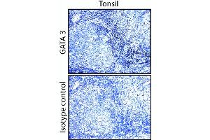 GATA3 staining on human tonsil and breast. (GATA3 抗体)