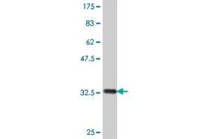 Western Blot detection against Immunogen (32. (PIGM 抗体  (AA 35-96))