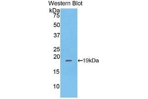 Detection of Recombinant PHLDA2, Mouse using Polyclonal Antibody to Pleckstrin Homology Like Domain Family A, Member 2 (PHLDA2) (PHLDA2 抗体  (AA 9-140))