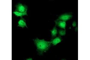 Anti-SHPK mouse monoclonal antibody (ABIN2454861) immunofluorescent staining of COS7 cells transiently transfected by pCMV6-ENTRY SHPK (RC204421). (SHPK 抗体)