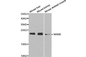 Western blot analysis of extracts of various cell lines, using MSMB antibody. (MSMB 抗体)
