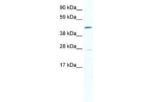 WB Suggested Anti-SMYD1 Antibody Titration:  0. (SMYD1 抗体  (N-Term))