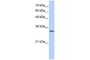 Sideroflexin 1 antibody used at 1 ug/ml to detect target protein. (SFXN1 抗体  (N-Term))