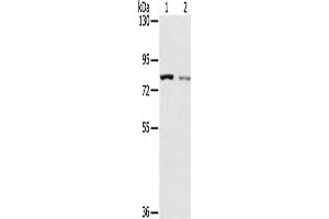 Gel: 6 % SDS-PAGE, Lysate: 40 μg, Lane 1-2: A549 cells, A172 cells, Primary antibody: ABIN7192629(SPATA5L1 Antibody) at dilution 1/200, Secondary antibody: Goat anti rabbit IgG at 1/8000 dilution, Exposure time: 2 minutes (SPATA5L1 抗体)
