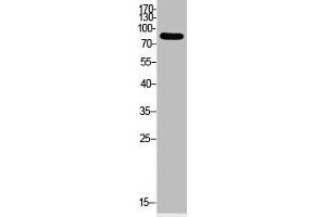 Western Blot analysis of HeLa cells using Acetyl-Ub (K33) Polyclonal Antibody (UBA52/RPS27A/UBB/UBC (acLys33) 抗体)