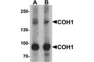 Western blot analysis of COH1 in SK-N-SH cell lysate with COH1 Antibody  antibody at (A) 1 and (B) 2 μg/ml. (VPS13B 抗体  (N-Term))