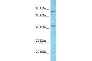 Host:  Rabbit  Target Name:  SIM2  Sample Type:  A549 Whole Cell lysates  Antibody Dilution:  1. (SIM2 抗体  (Middle Region))