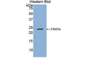 Western Blotting (WB) image for anti-TIMP Metallopeptidase Inhibitor 1 (TIMP1) (AA 25-207) antibody (ABIN1078585) (TIMP1 抗体  (AA 25-207))
