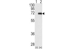 Western Blotting (WB) image for anti-Protein Kinase C, iota (PRKCI) antibody (ABIN3002935)