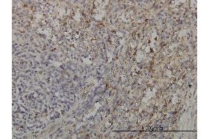 Immunoperoxidase of monoclonal antibody to GRAP2 on formalin-fixed paraffin-embedded human spleen. (GRAP2 抗体  (AA 226-315))