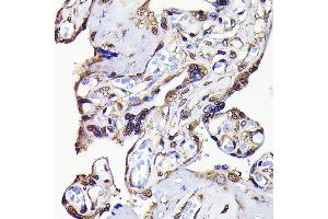 Immunohistochemistry of paraffin-embedded human placenta using GAPDH Rabbit mAb (ABIN7267454) at dilution of 1:100 (40x lens). (GAPDH 抗体)