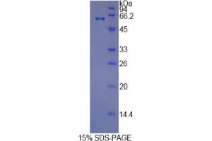 SDS-PAGE analysis of Human HRG Protein. (HRG 蛋白)