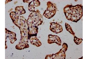 IHC image of ABIN7169168 diluted at 1:400 and staining in paraffin-embedded human placenta tissue performed on a Leica BondTM system. (RIOK2 抗体  (AA 316-448))