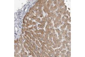 Immunohistochemical staining of human liver with PRSS38 polyclonal antibody  shows cytoplasmic positivity in hepatocytes. (PRSS38 抗体)
