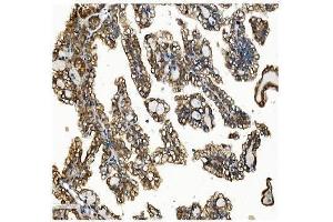IHC analysis of VAPB using anti-VAPB antibody (ABIN5693292). (VAPB 抗体  (AA 2-55))