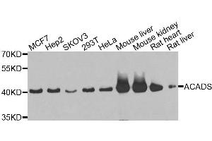 Western blot analysis of extracts of various cell lines, using ACADS antibody. (ACADS 抗体  (AA 1-260))