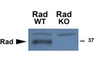 Western Blotting (WB) image for anti-Ras-Related Associated with Diabetes (RRAD) (Internal Region) antibody (ABIN2465070) (RRAD 抗体  (Internal Region))