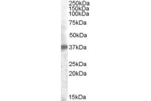 Image no. 1 for anti-Tumor-Associated Calcium Signal Transducer 2 (TACSTD2) (Internal Region) antibody (ABIN375030) (TACSTD2 抗体  (Internal Region))