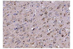 IHC analysis of TIMM8A/DDP using anti-TIMM8A/DDP antibody (ABIN7600039). (TIMM8A/DDP 抗体  (AA 14-97))