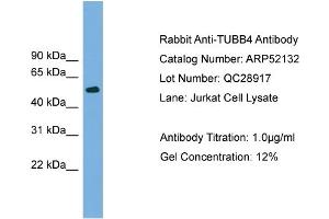WB Suggested Anti-TUBB4  Antibody Titration: 0. (TUBB4 抗体  (N-Term))