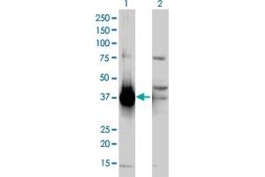 Western Blot analysis of AKR1C2 expression in transfected 293T cell line by AKR1C2 polyclonal antibody (A01). (AKR1C2 抗体  (AA 224-323))