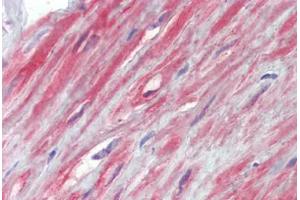 Prostate, fibromuscular stroma, Human: Formalin-Fixed, Paraffin-Embedded (FFPE) (TRPC1 抗体  (AA 722-733))