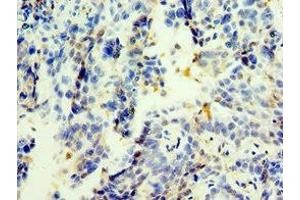 Immunohistochemistry of paraffin-embedded human lung tissue using ABIN7173394 at dilution of 1:100 (TGS1 抗体  (AA 714-853))