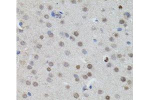 Immunohistochemistry of paraffin-embedded Mouse brain using MYCN Polyclonal Antibody (MYCN 抗体)